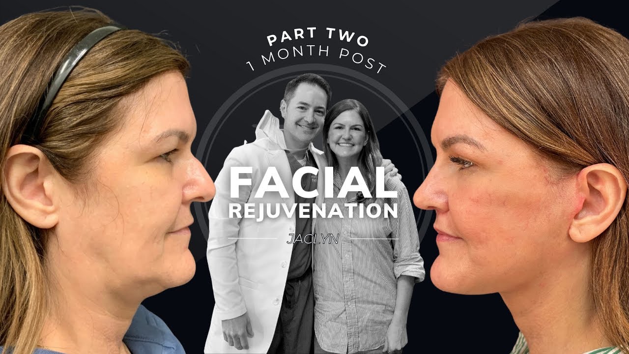 Robb Facial Plastic Surgery