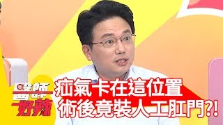 疝氣卡在「這位置」？術後竟須裝人工肛門？！【醫師好辣】 20190808  part3  EP789 江坤俊 楊晨熙
