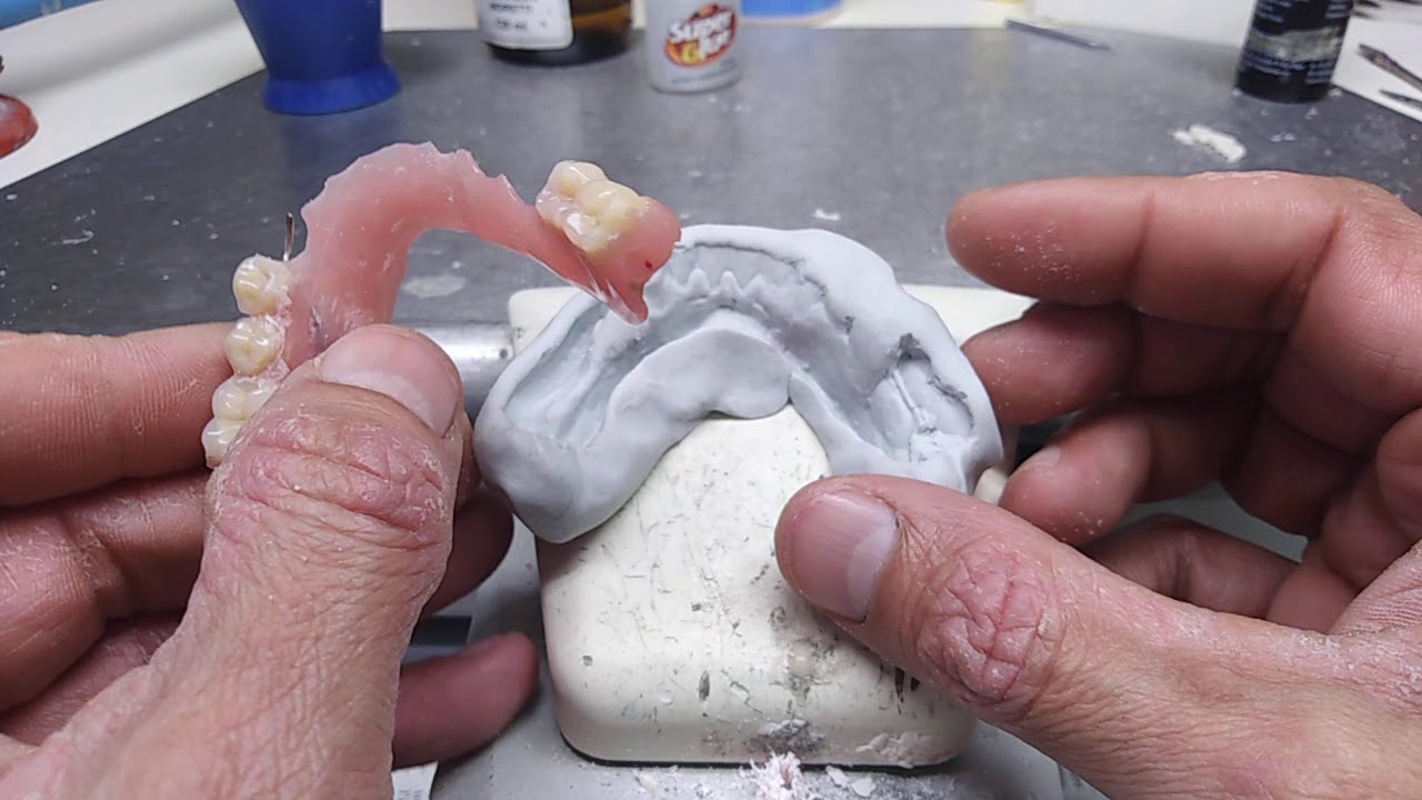 Riparazione protesi mobile. 6 Dental Formula project
