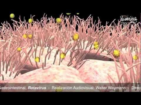 Mustasa powder para sa pagbaba ng timbang Mawalan ng timbang pagkatapos ng pag-alis ng mga fibroids