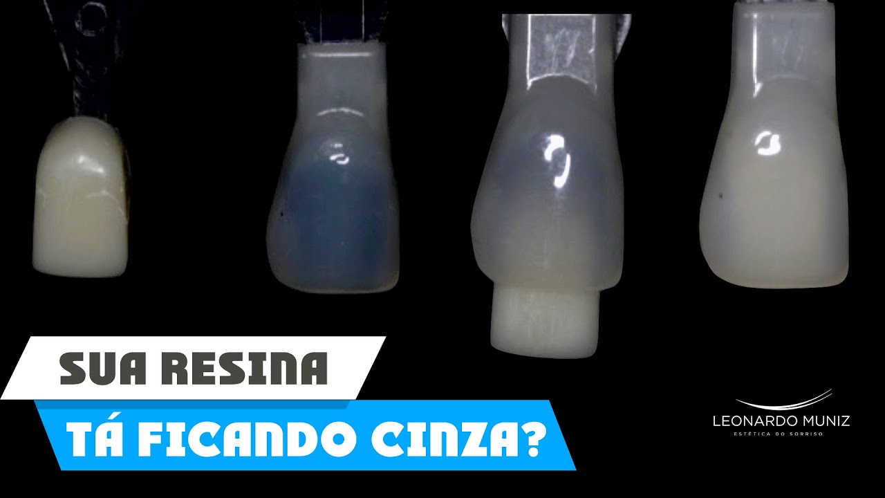 Como não errar a cor e a translucidez das Resinas Compostas?