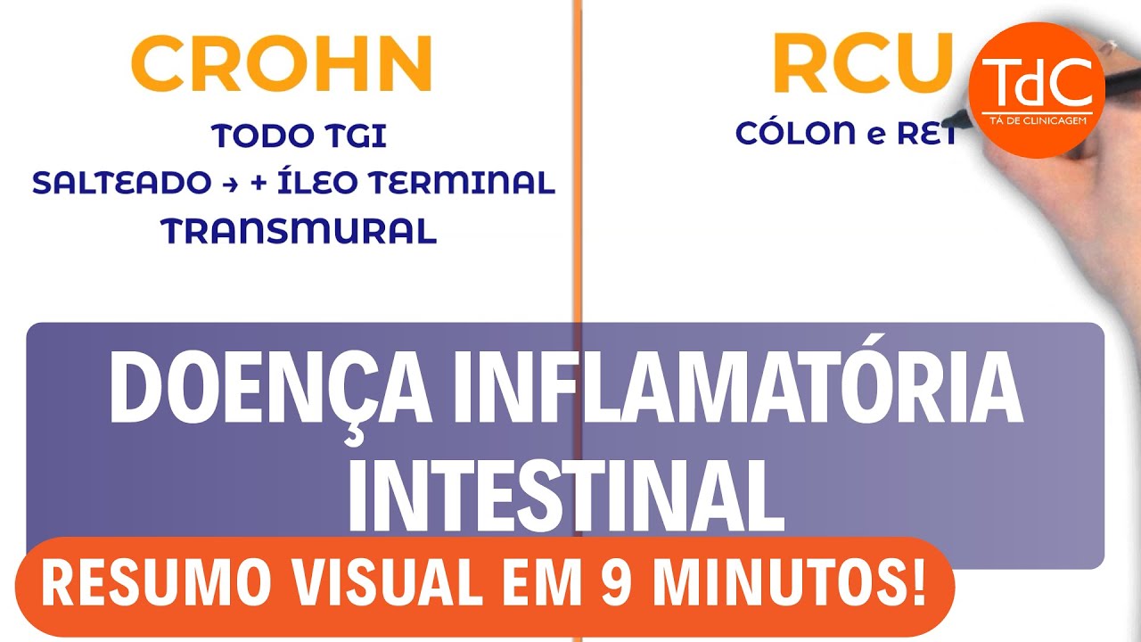 Doença inflamatória intestinal: Resumo em 8 minutos!