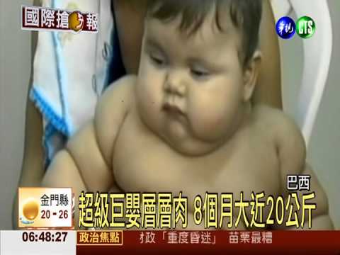 巴西超級巨嬰 8個月大近20公斤