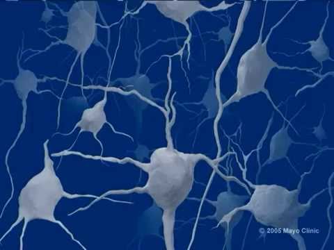Mayo Clinic Medical Animation - Lewy Body Dementia