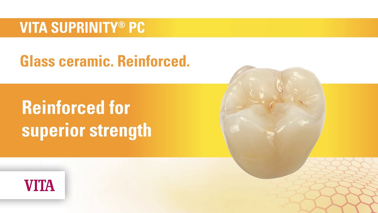 Les blocs Vita Suprinity PC ( Anglais)