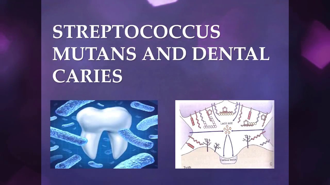 Streptococcus Mutans and Dental Caries - YouTube