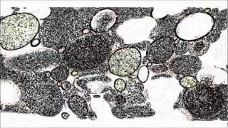 Trey Anastasio - "What's Done"