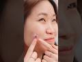 Would You Pop a Magic Pimple?