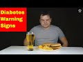 The Top 3 Warning Signs Of Diabetes