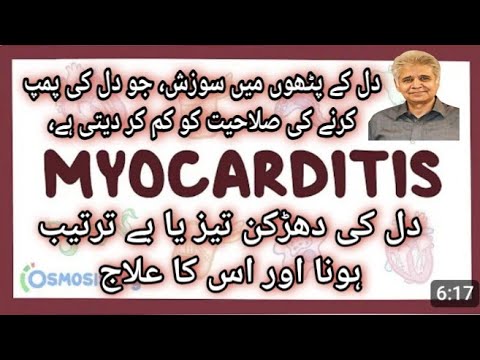 Myocarditis Causes Sign and Symptoms and it's Treatment | Dr Ali Muhammad