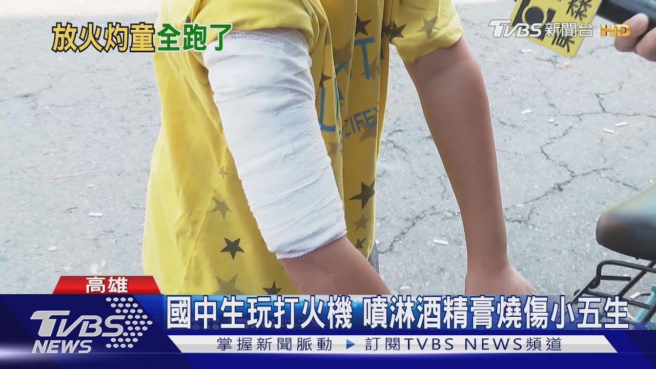國中生點火燒傷小五童　縱火少年找到了