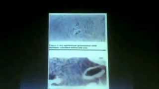 3_ Dr. Faisal - Hemoglobin Derived Pigments Extracellular Depositions Amyloidosis part 3