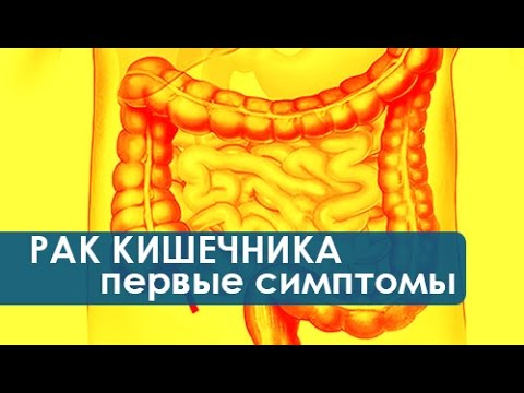 Остеохондроз растягивания шеи Болит поясница на 12 неделях беременности