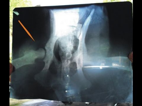Болят лимфоузлы на шее около ушей Рентгеновский снимок здорового плечевого сустава