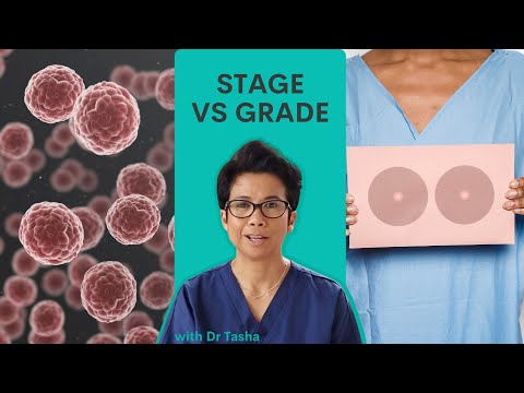 What is stage and grade in breast cancer? With Dr Tasha