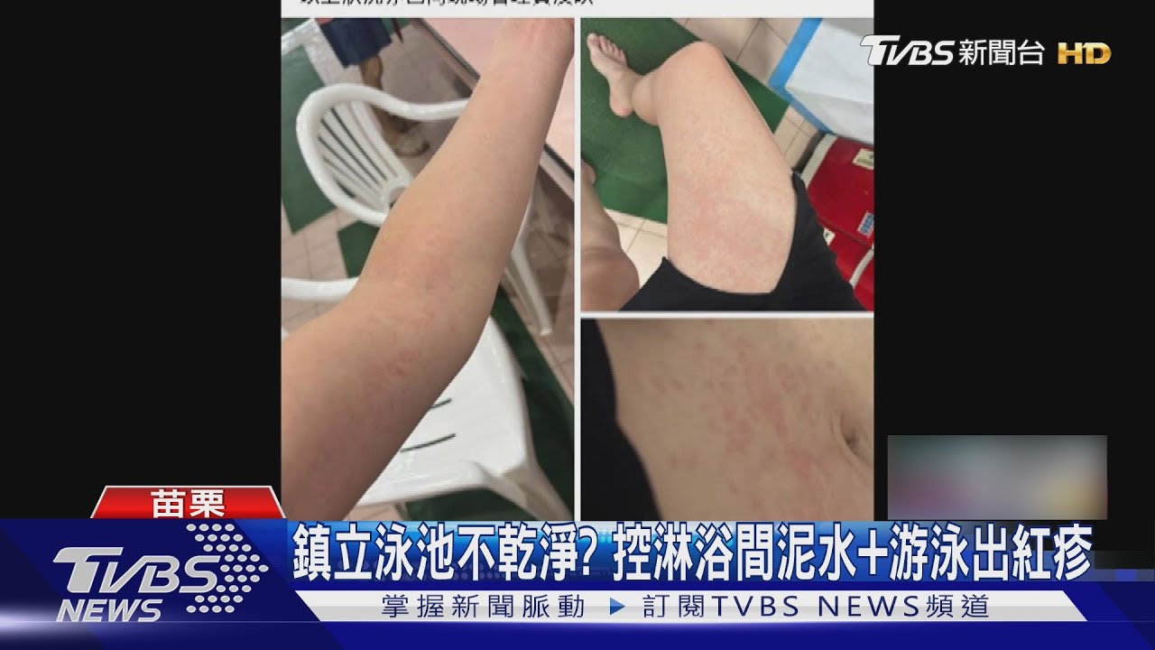 黃泥水噴出水龍頭!苗栗泳池驚見「OK繃漂浮」 泳客游完「爆紅疹」