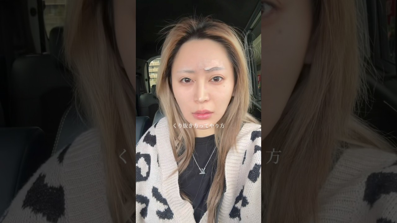 念願のホクロ取ってきたじぇ。