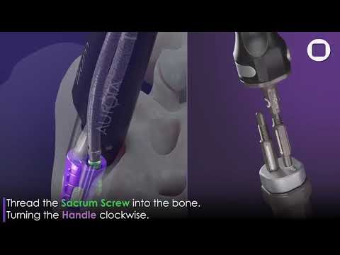 Aurora Spine: SiLO TFX™