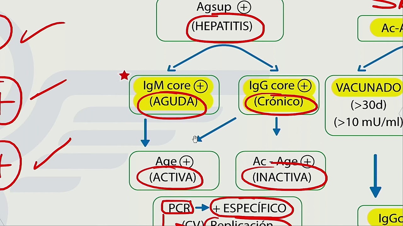 Hepatitis - Mapa mental - Dr. Jaime Torres