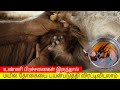 உண்ணி பிரச்சனையிலிருந்து உடனடியாக வ�