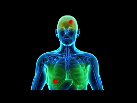 What is Chemotherapy? | Brit Lab