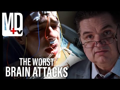 When the Brain Attacks Its Host | Chicago Med And More | MD TV