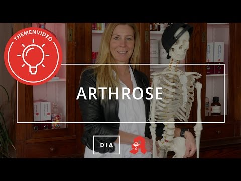 Arthrose - Ursachen, Symptome, Behandlung - Deutsche Internet Apotheke