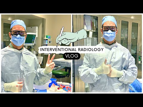 Interventional Radiology Vlog - Day in the Life of a DOCTOR (Residency Vlog)