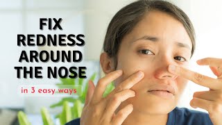 How to Fix Redness Around Nose in 3 Easy Ways