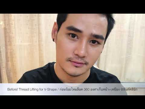 ร้อยไหม คอ ล ลา เจน