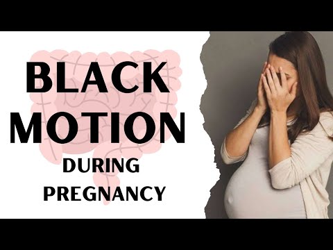 Black Motion during pregnancy | Dr. Abinaya Vijayakumar #blackpoop #blackstoolinpregnancy