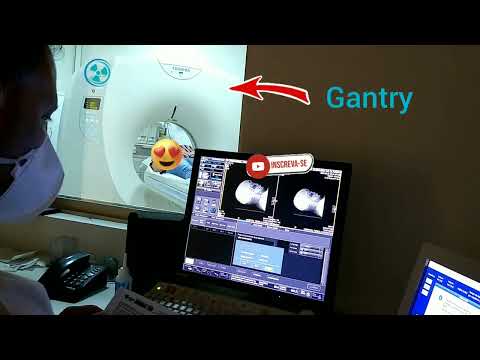 Tomografia de Crânio sem Contraste.