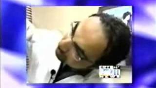 Beverly Hills Plastic Surgery News – Lip Augmentation with Collagen