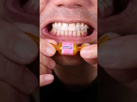 Asmr candy With teeth sound Satisfying Dr Trishna #satisfying #drteeth #funnycute