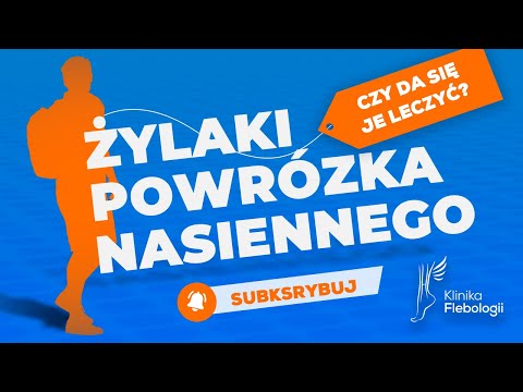 Żylaki powrózka nasiennego - czy da się je leczyć?