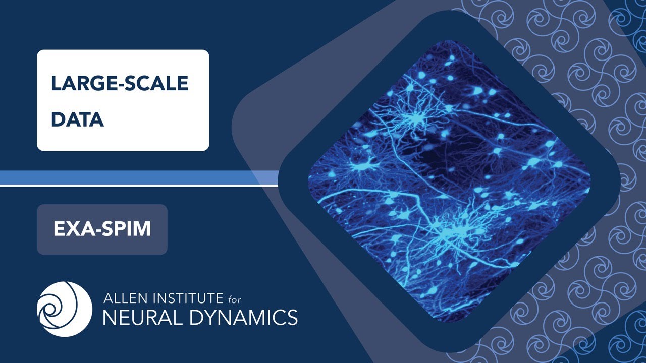 Large-scale Data Handling | Exa-SPIM