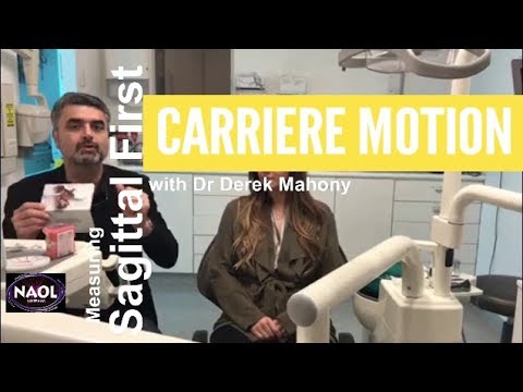 Carriere Motion - Revolutionising Orthodontics