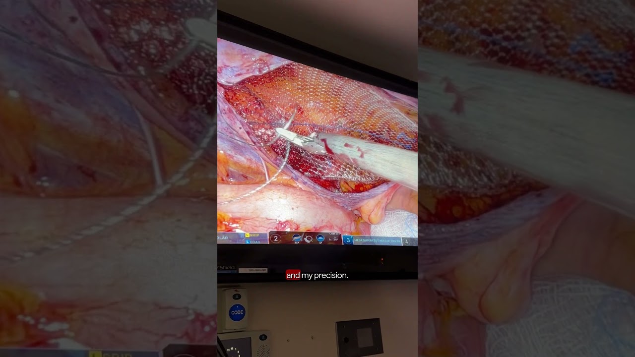 Meet Da Vinci, the Newest Member of Our Surgical Team