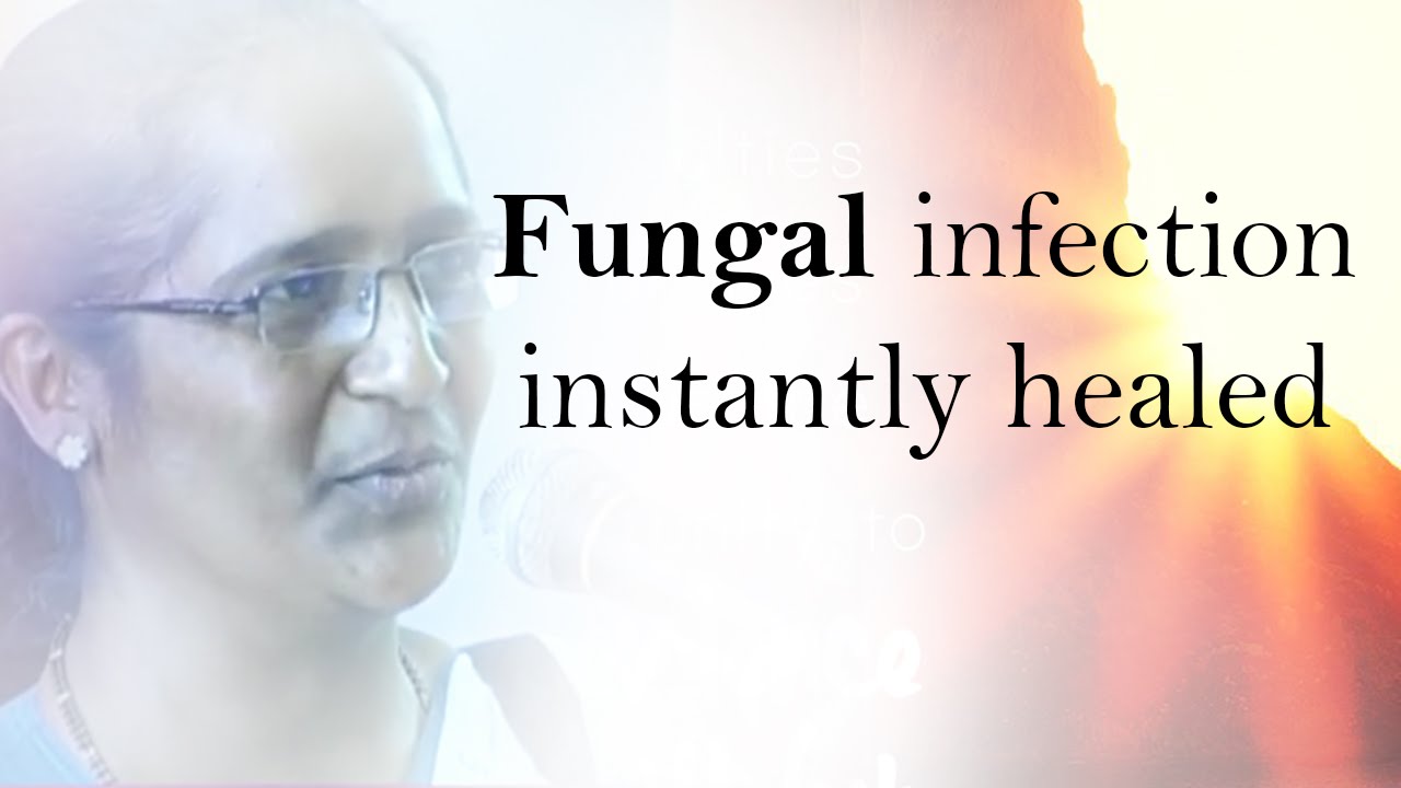 Fungal infection instantly healed at Grace Ministry Mangalore