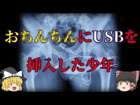 好奇心が行き過ぎると: 少年がペニスに USB ケーブルを突き刺す