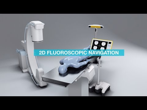 Brainlab Fluoro 2D Registration and Navigation