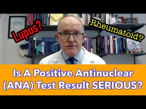 Is A "Positive" Antinuclear (ANA) Antibodies Test Result Serious?