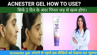 acnestar gel kaise use kare | acnestar gel how to use 🤔| Know the dark truth before applying it. ...