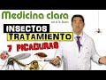 7 INSECT BITES TREATMENT Special ATTENTION To The LAST 2 Clear Medicine