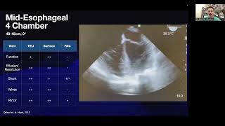 TEU in the ICU: A Multi-tool for the Intensivist