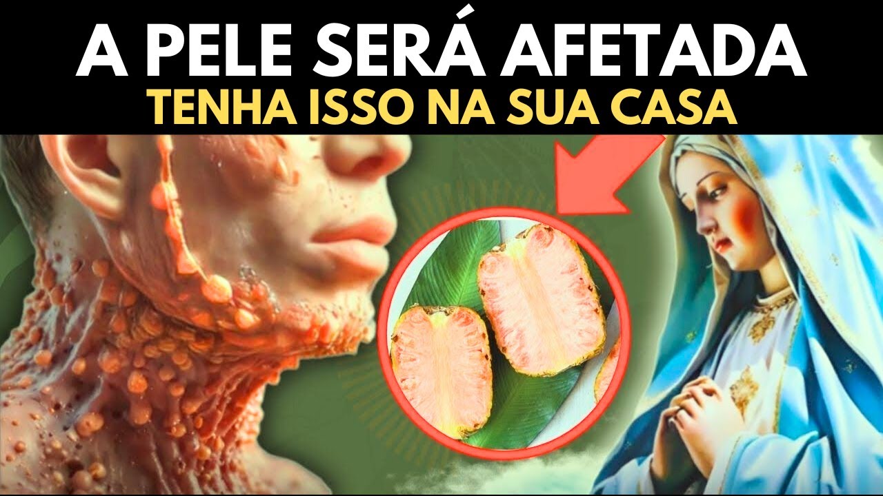 PADRE ALERTA: NOVA PRAGA AFETARÁ A PELE, ENTÃO TENHA ISTO EM SUA CASA - MENSAGEM DE NOSSA SENHORA