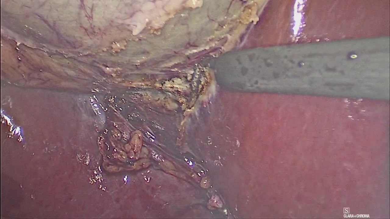 Laura Irazema Hernández González-4