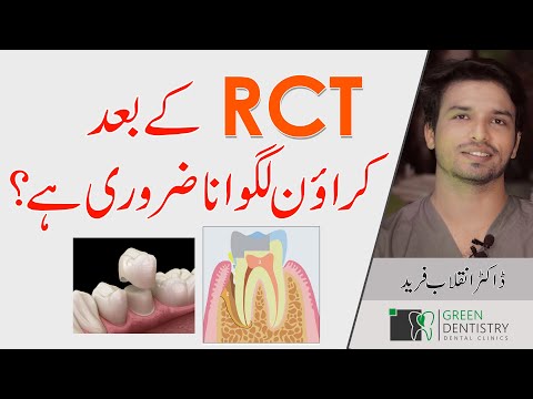Why Crown ( tooth Cap) is necessary after ROOT CANAL TREATMENT? | URDU | @InqalabFareed