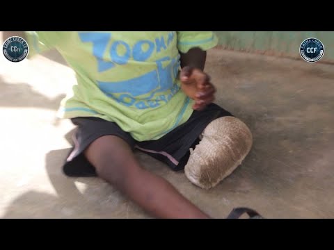 THEY CUT MY SON'S LEG AFTER MY HUSBAND'S DEATH