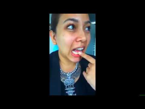 Teeth Whitening Shah Alam 1st Dental Clinic